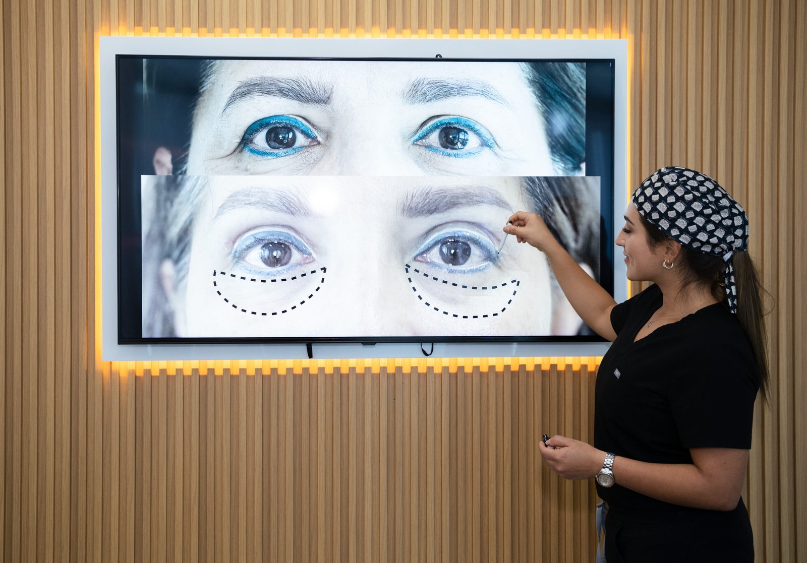 Aplicación de Botox